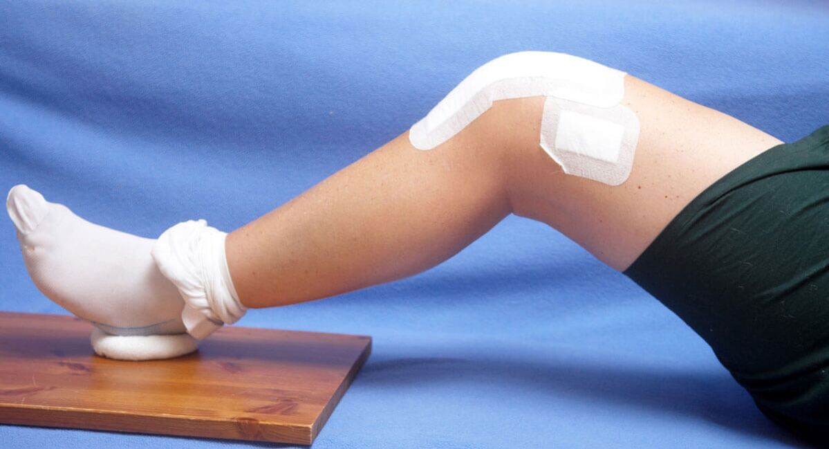 травма коленного сустава как причина артроза
